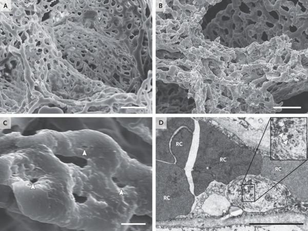他們用人類史上最強的X光，告訴我們新冠患者的肺傷成了什麼樣
