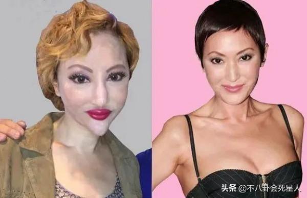 港圈美人也動臉，這10位女星，動臉後有人變刻薄，有人面目全非