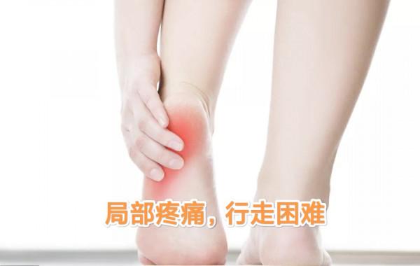 走路腳後跟疼，到底是什麼原因？醫生：帶你揪出跟痛症的真相