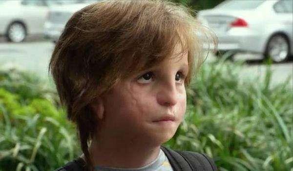 英國男子臉部畸形，憑魅力迎娶美女大學生，孩子出生後笑不出來了