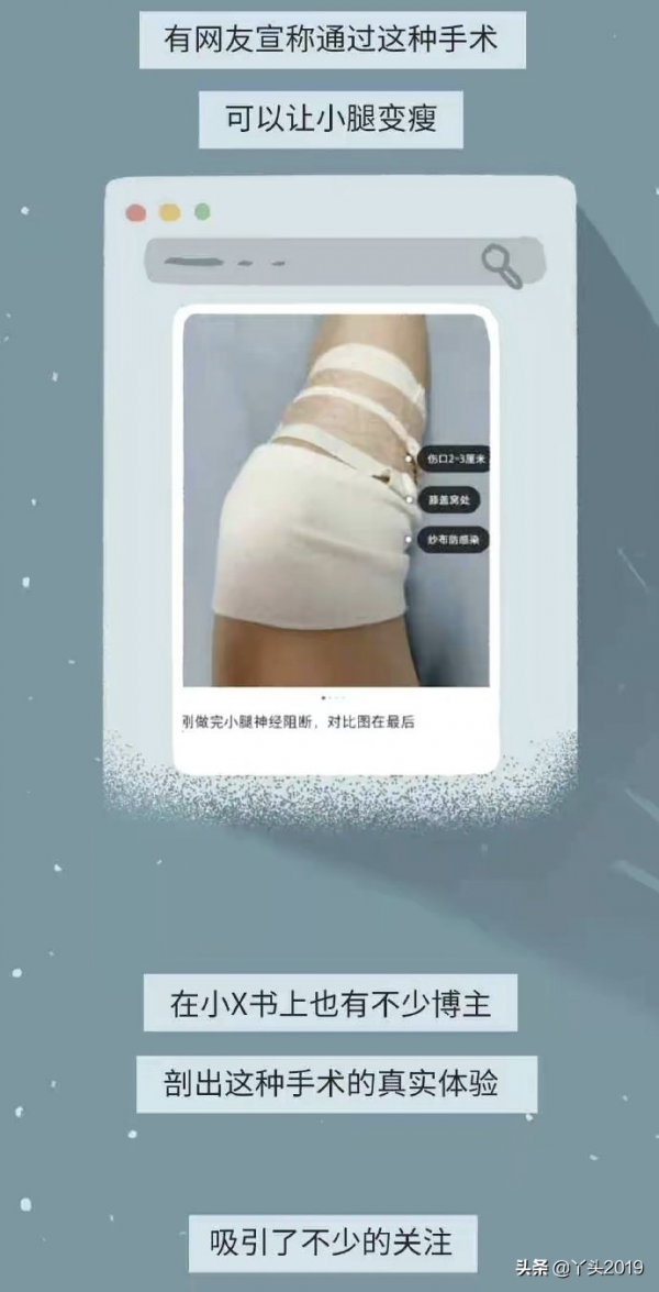 為“變美”挑斷小腿、弄殘耳朵?女人整容有多魔怔?#漫畫# 為“變美”挑斷小腿、弄殘耳朵?女人整容有多魔怔?#漫畫#