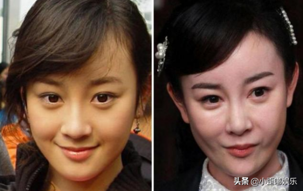 4位女星的整容“塌房路”，有人整成“滅霸”，一個比一個不自然