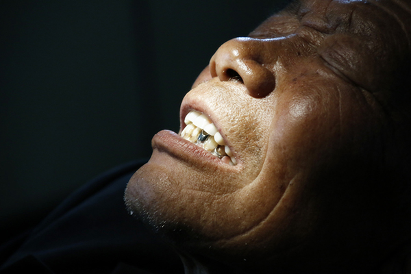 衰老真的是一瞬間的事嗎?身體的5個器官告訴你,衰老早就出現了 衰老真的是一瞬間的事嗎?身體的5個器官告訴你,衰老早就出現了