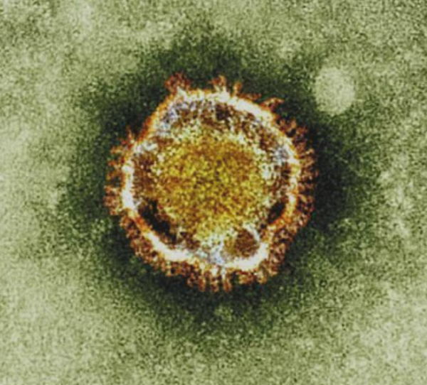 日本新病毒又控制不住了？集團感染、密切接觸者激增774人