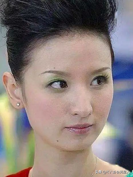 中年女星整容後遺症一堆！臉像鞋拔子，不敢做大表情，演戲沒法看