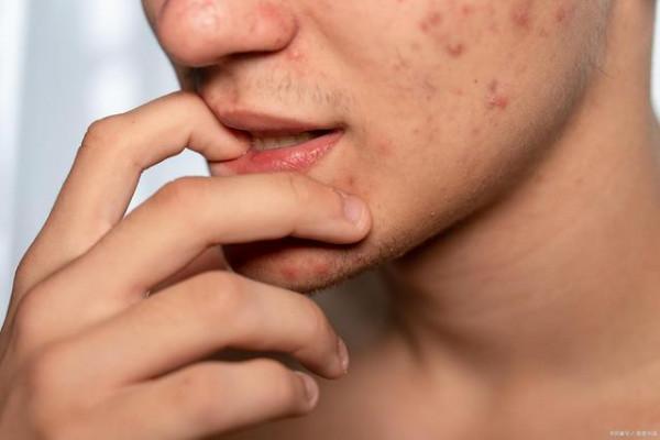 老中醫教你簡易方法區分寒溼和溼熱體質