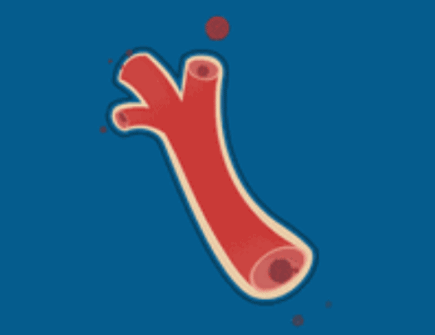 名醫張錫純留下一古方：鎮肝熄風湯，可治頭暈，耳鳴，口眼歪斜等