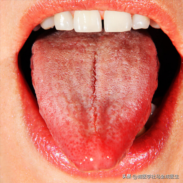 肝火大，總口苦、吐酸水，兩味中藥泡水，清肝化火，制酸止痛