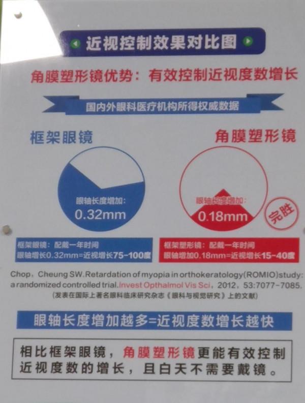 我們的角膜塑形鏡使用歷程&lpar;14）&mdash;&mdash;年後複查