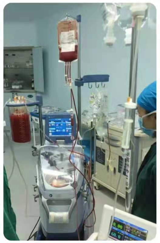 生死時速！女子命懸一線，失血量達全身80%與死神賽跑，多科合作成功搶救