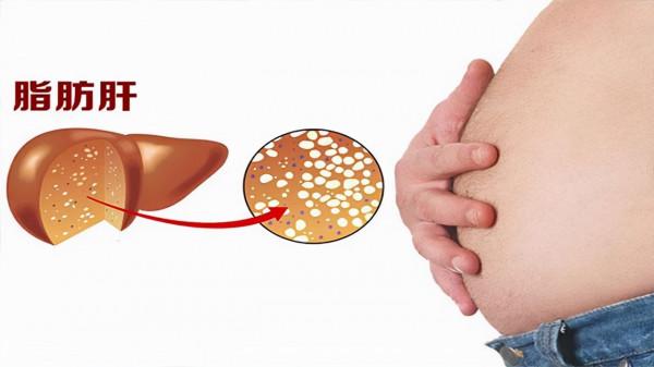 女人常吃無花果，或能收穫這4大好處，提示：這三類人需忌口