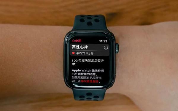 等了 3 年，國行版 Apple Watch 心電圖功能終於來了