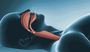 感覺孩子越長越醜,去醫院一查居然是病... 感覺孩子越長越醜,去醫院一查居然是病...