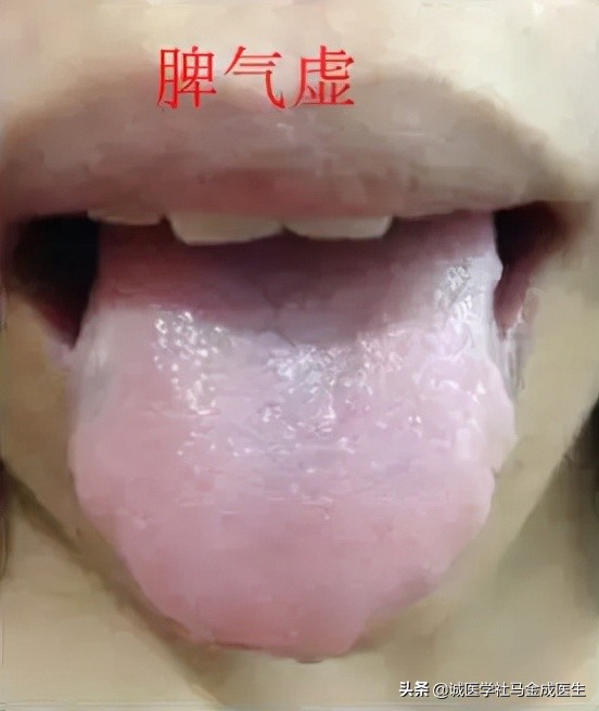 六種不同常見體質，看你屬於哪種，看哪種方法適合你