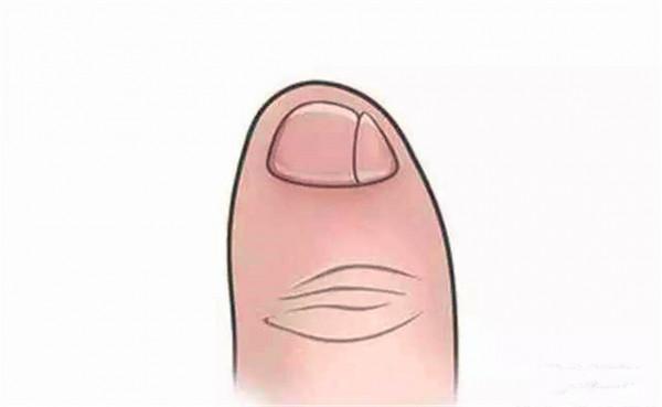 小腳趾甲長成兩瓣是啥人？據說朱元璋刀砍認親，或是純種漢人後代