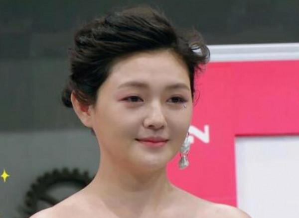 凹凸不平、眼睛擠成一條縫,“發麵饅頭”臉毀了多少高顏值明星? 凹凸不平、眼睛擠成一條縫,“發麵饅頭”臉毀了多少高顏值明星?