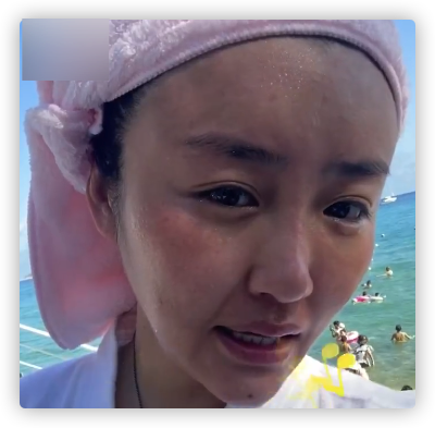 本山傳媒嬌嬌自曝整容，曬術後照被指認不出，多次割眼皮腫脹明顯