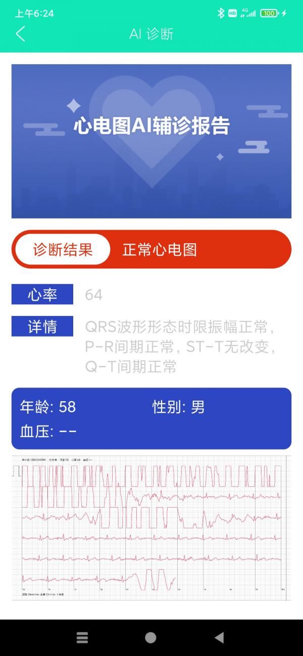 體驗DiDo E10：不僅是智慧手錶，更是追蹤健康的神器