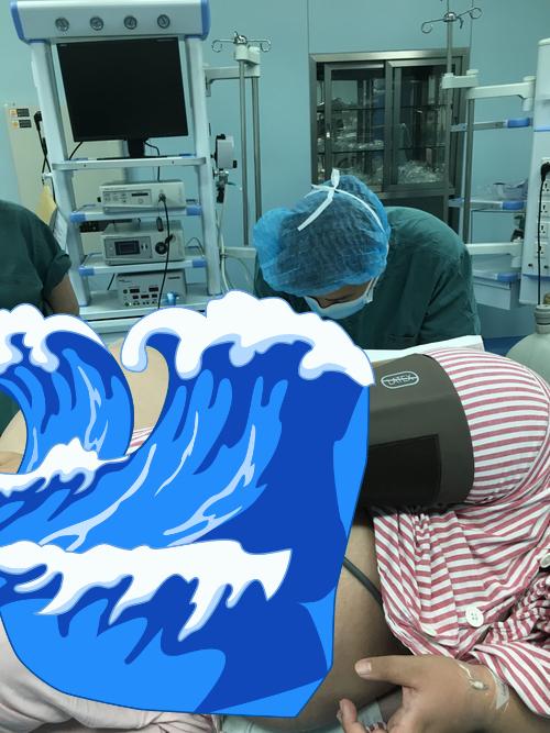 酒桌上的腦出血提醒大家：每一個高血壓的人，都是在拿命喝酒