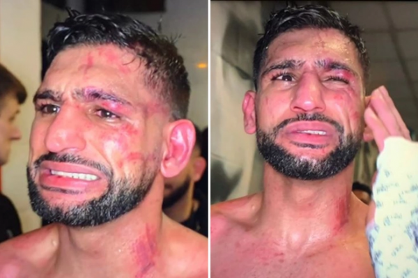 卡汗慘敗布魯克，臉被揍得傷痕累累