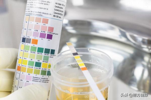 高友鶴教授：為什麼尿液是疾病早期標誌物的來源？