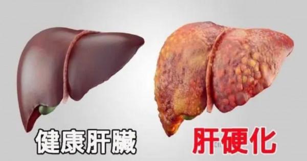 身上出現很多小紅點，不痛不癢是怎麼回事？這些病別心存僥倖