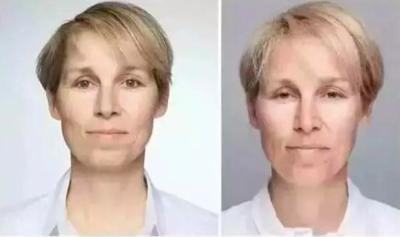 有的人腿上沒有毛髮是怎麼回事? 有的人腿上沒有毛髮是怎麼回事?