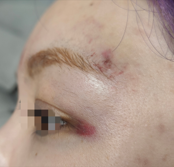 中超冠軍球員酒後毆打女子，被處行政拘留十日