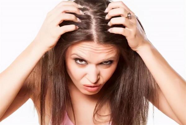 秋季頭皮屑多，3種食物儘量少吃，2個小妙招或能減少頭皮屑