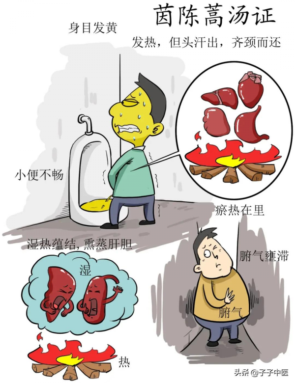 全本《傷寒論》高畫質漫畫版——簡單、好看、好掌握 全本《傷寒論》高畫質漫畫版——簡單、好看、好掌握