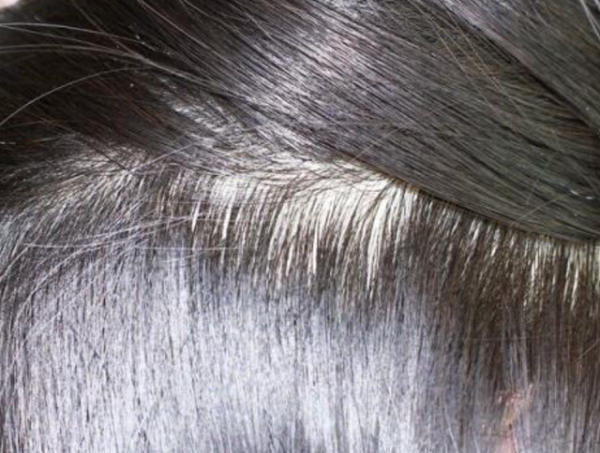 堅持用&OpenCurlyDoubleQuote;鹽水&rdquo;洗頭，堅持一段時間，會有4種變化，不妨試試
