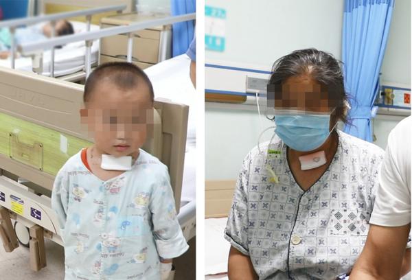 【科普系列】梨狀窩瘻最大的危害在於延誤治療遷延不愈