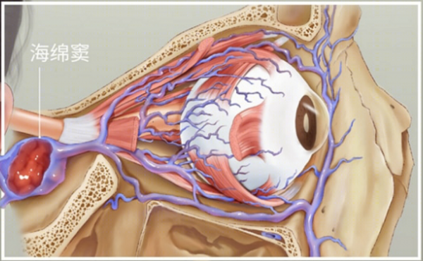 8歲男童摳鼻屎將細菌送進大腦,壞習慣險送人命,口鼻三角碰不得 8歲男童摳鼻屎將細菌送進大腦,壞習慣險送人命,口鼻三角碰不得