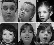 臨床基本功:一眼診病 臨床基本功:一眼診病