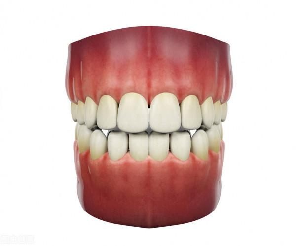 大家見過給牙齒上個鎖的嗎？