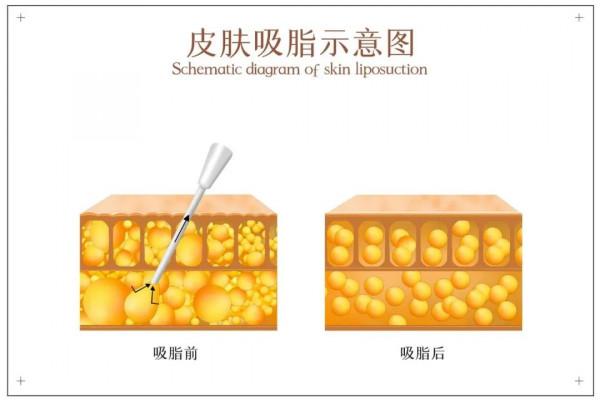 如何保持面部年輕化 如何保持面部年輕化