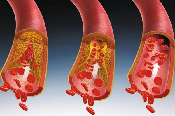 吃晚飯時，長期喝點“白酒”的人，身體會怎樣？