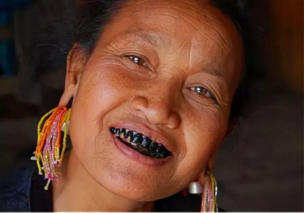 日本女人為什麼喜歡把牙齒染成黑色