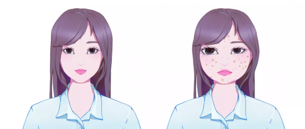 臉上的這6個變化可能是生病了?趕緊看看你的臉 臉上的這6個變化可能是生病了?趕緊看看你的臉