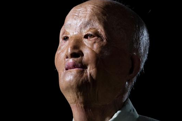 十九歲那年曾是帥小夥，汽油彈毀容老兵，“活著的邱少雲”塗伯毅