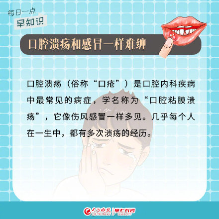 4招有效預防口腔潰瘍 4招有效預防口腔潰瘍