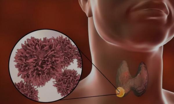 優甲樂效果好，服用期間也要警惕可能發生的4個副作用