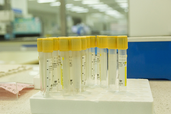 62歲教授，血管狹窄從90%降低到70%，支架都免了，患者分享方法