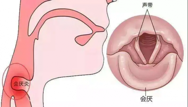 揭秘冬季高發耳鼻喉疾病,提前為健康打好“預防針” 揭秘冬季高發耳鼻喉疾病,提前為健康打好“預防針”