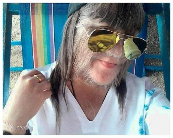 泰國女孩臉上長滿毛髮，長相特殊受盡嘲諷，父母卻視她為掌上明珠