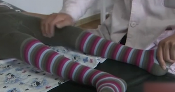 外國女孩天生雙腿畸形，頂級醫院稱無法治癒，結果被中醫3月看好