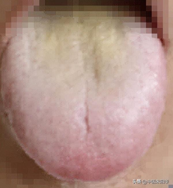 對鏡查舌早知病!中醫教您如何透過舌頭快速識別疾病 對鏡查舌早知病!中醫教您如何透過舌頭快速識別疾病