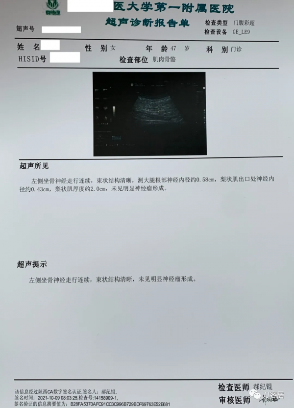 查體的重要性，一直按照腰椎間盤突出症治療的脊髓型頸椎病