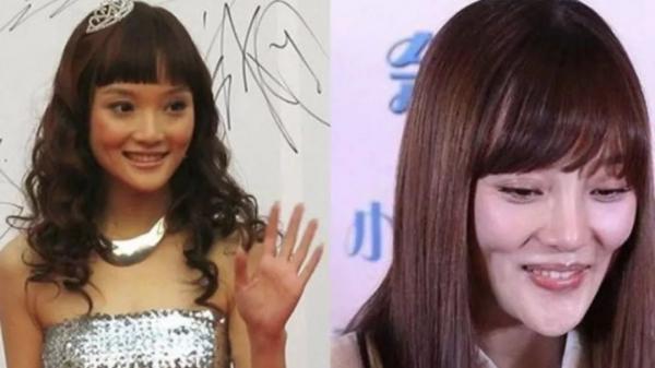 娛樂圈這8位女星被整容毀掉，有人臉僵如石，有的“堪比換頭”