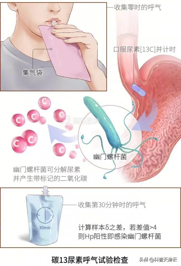 胃不好的人,儘量別吃這種藥!這4類藥才能保護你的胃 胃不好的人,儘量別吃這種藥!這4類藥才能保護你的胃